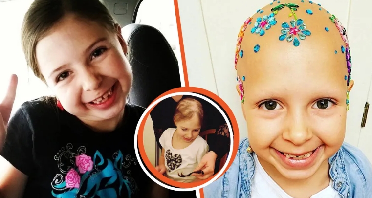 7 Year Old Girl Who Abruptly Lost Hair Forever Finds Beauty in Baldness by Adorning Her Head